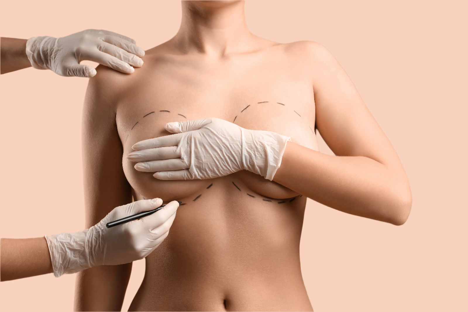 Breast Augmentation Plastic Surgery